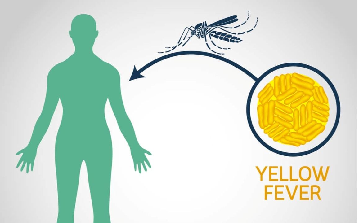 yellow fever